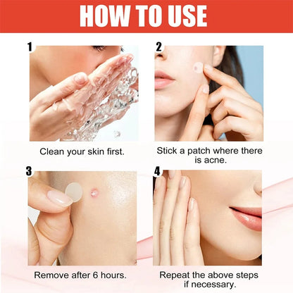 144pcs Face Acne Patch Invisible Skin Care Pimple Acne Patches Anti-inflammatory Healing Absorbing Spot Sticker Covering Acne