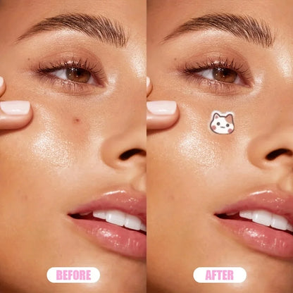12pcs Cute cartoon pimple patch, suitable for many occasions, skin gentle, waterproof, for both men and women