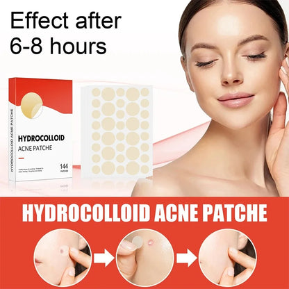 144pcs Face Acne Patch Invisible Skin Care Pimple Acne Patches Anti-inflammatory Healing Absorbing Spot Sticker Covering Acne
