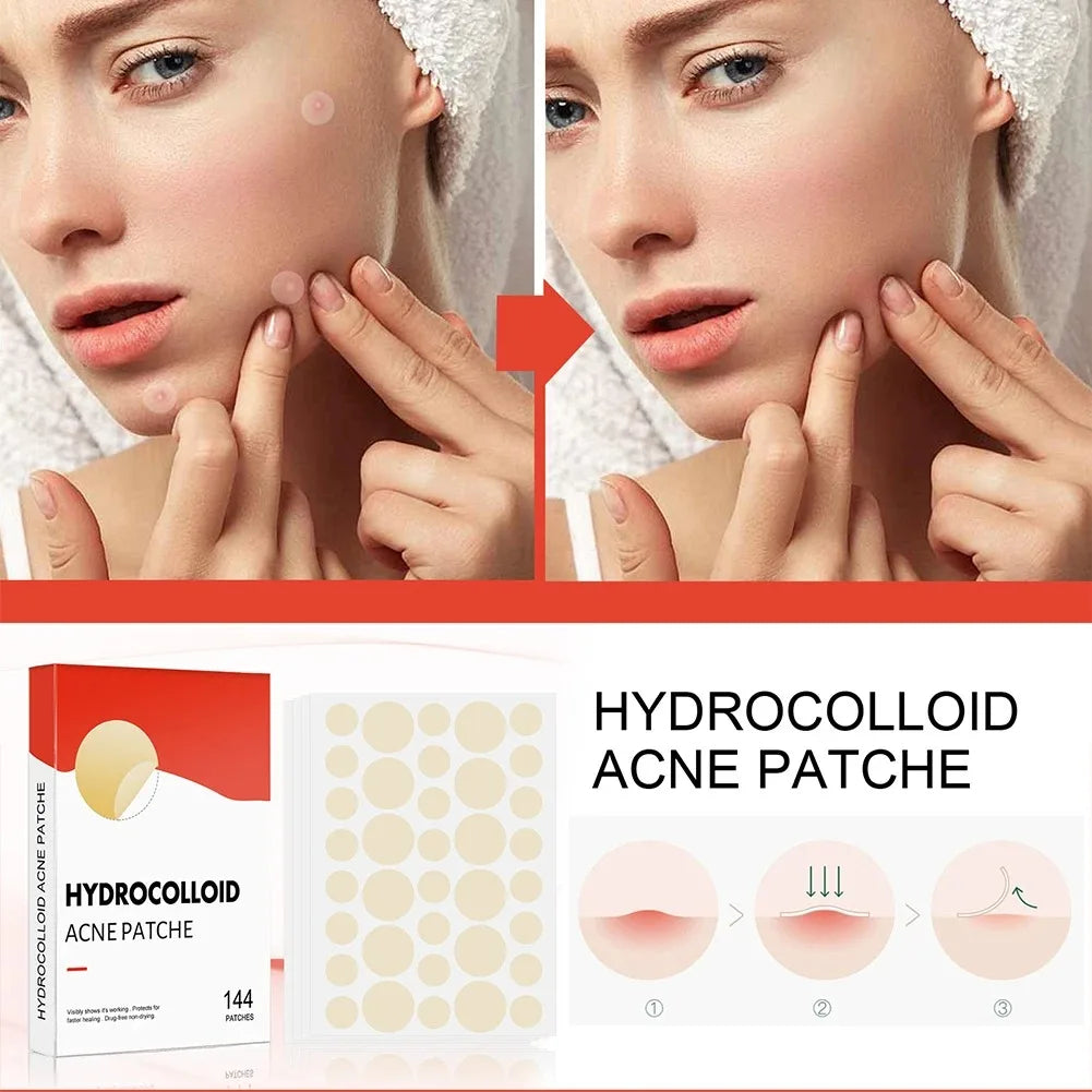 144pcs Face Acne Patch Invisible Skin Care Pimple Acne Patches Anti-inflammatory Healing Absorbing Spot Sticker Covering Acne