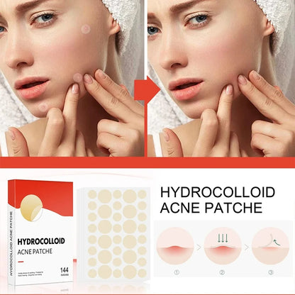 144pcs Face Acne Patch Invisible Skin Care Pimple Acne Patches Anti-inflammatory Healing Absorbing Spot Sticker Covering Acne