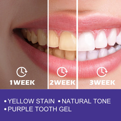 V34 Dental Toothpaste Whitening Instant Teeth Whitener Tooth Stain Tartar Hygiene Fresh Breath Cleaner Oral