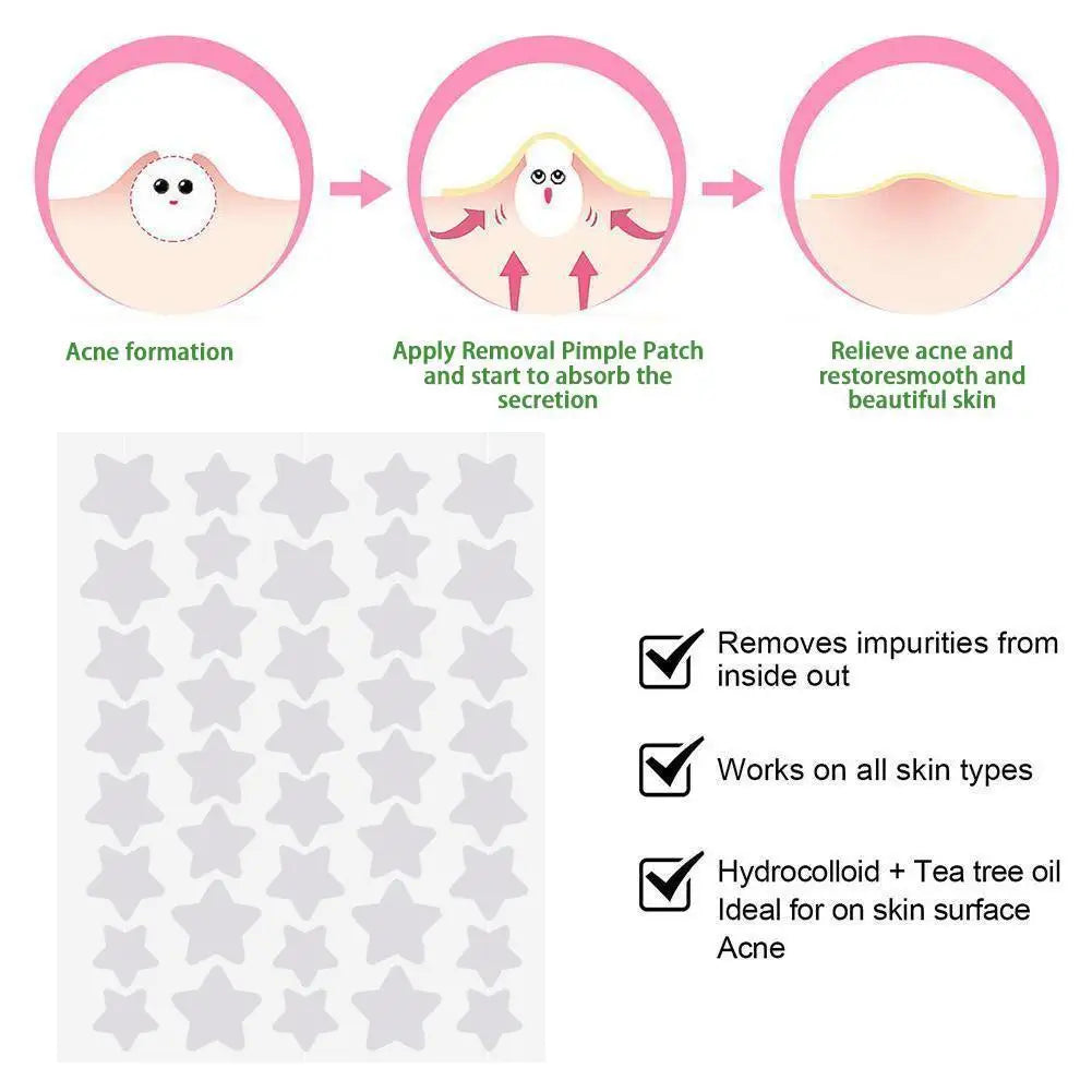 40pcs Hydrocolloid Colorful Pimple Patches Pimple Cover Sticker Star Shaped Invisible Pimple Cover Removal Pimple Patch