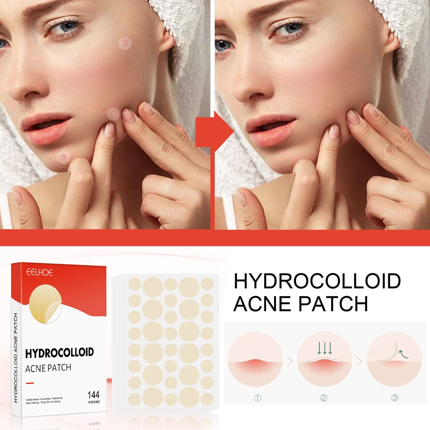 144pcs Face Acne Patch Invisible Skin Care Pimple Acne Patches Anti-inflammatory Healing Absorbing Spot Sticker Covering Acne